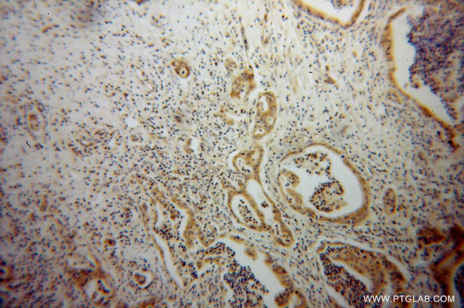 ATX3/ATXN3 Antibody in Immunohistochemistry (Paraffin) (IHC (P))