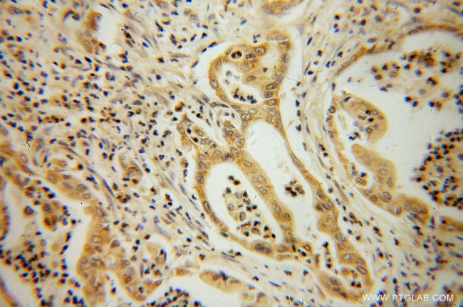 ATX3/ATXN3 Antibody in Immunohistochemistry (Paraffin) (IHC (P))