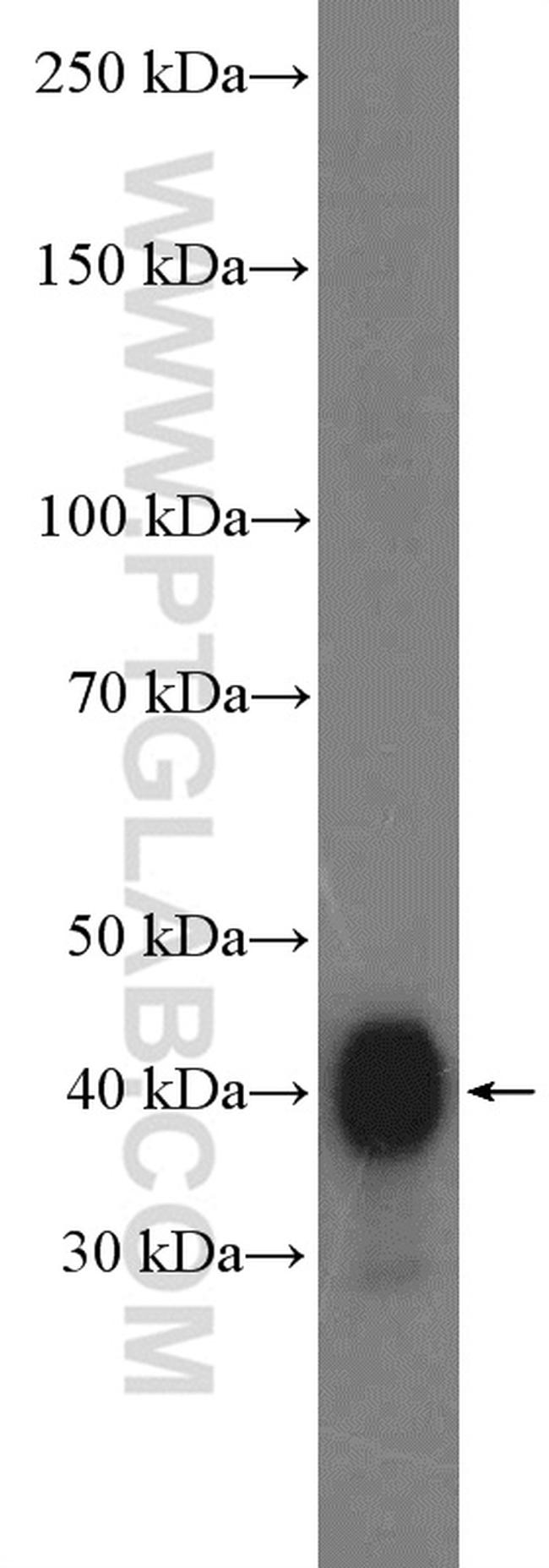 ATX3/ATXN3 Antibody in Western Blot (WB)