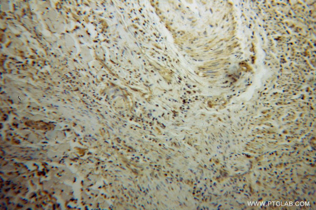 TAF7 Antibody in Immunohistochemistry (Paraffin) (IHC (P))