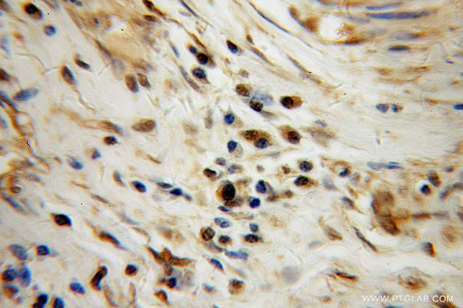 TAF7 Antibody in Immunohistochemistry (Paraffin) (IHC (P))