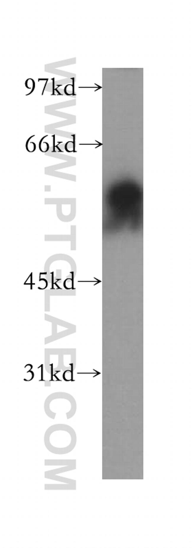 TAF7 Antibody in Western Blot (WB)