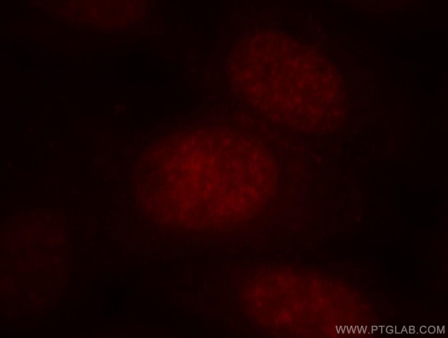 BATF Antibody in Immunocytochemistry (ICC/IF)