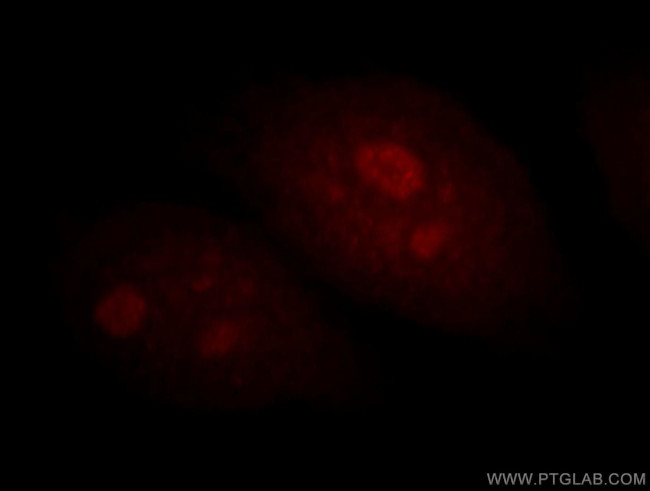 BATF Antibody in Immunocytochemistry (ICC/IF)