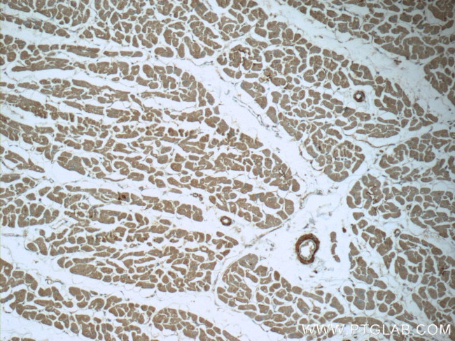 MTPN Antibody in Immunohistochemistry (Paraffin) (IHC (P))