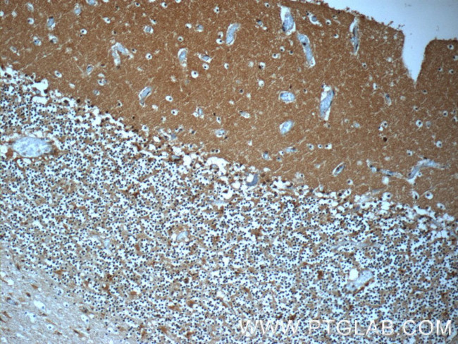 MTPN Antibody in Immunohistochemistry (Paraffin) (IHC (P))