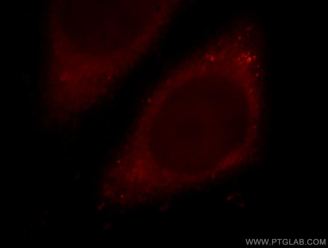 MTPN Antibody in Immunocytochemistry (ICC/IF)