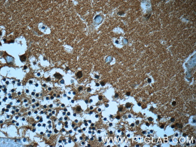 MTPN Antibody in Immunohistochemistry (Paraffin) (IHC (P))