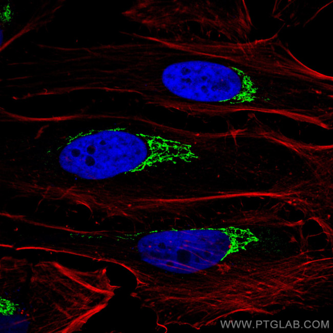 p115/USO1 Antibody in Immunocytochemistry (ICC/IF)