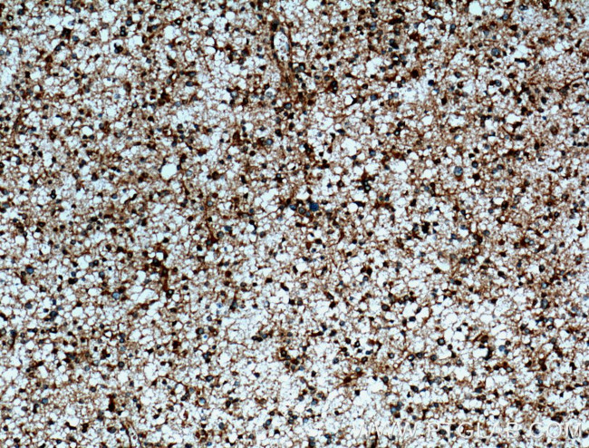 p115/USO1 Antibody in Immunohistochemistry (Paraffin) (IHC (P))