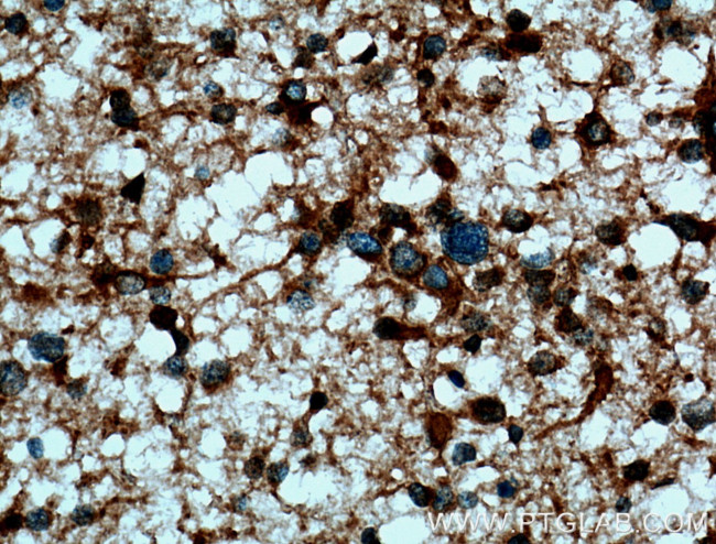 p115/USO1 Antibody in Immunohistochemistry (Paraffin) (IHC (P))