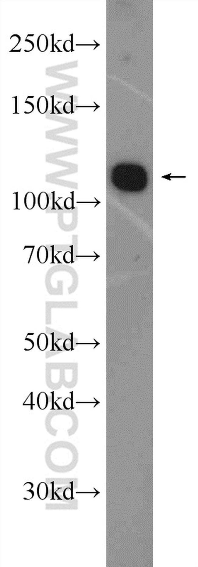 p115/USO1 Antibody in Western Blot (WB)