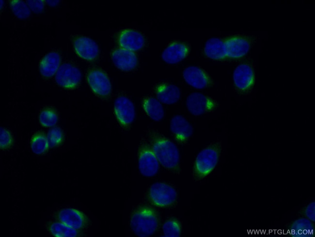 p115/USO1 Antibody in Immunocytochemistry (ICC/IF)