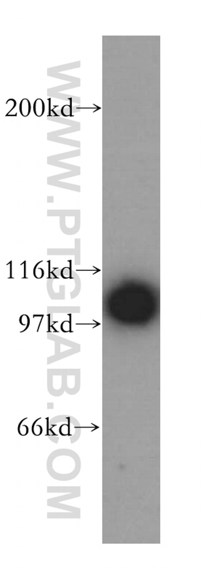 p115/USO1 Antibody in Western Blot (WB)