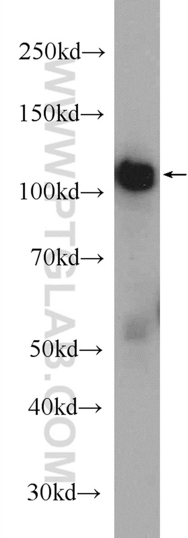 p115/USO1 Antibody in Western Blot (WB)