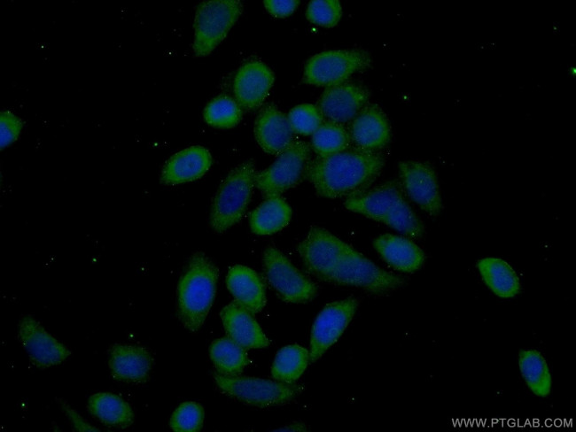 EEF2K Antibody in Immunocytochemistry (ICC/IF)