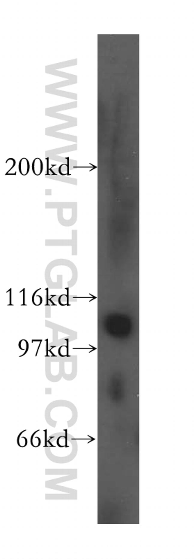 EEF2K Antibody in Western Blot (WB)