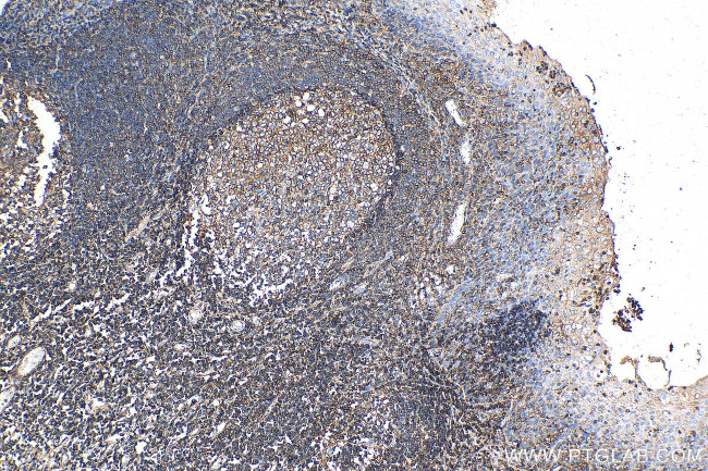 Beta-2-microglobulin Antibody in Immunohistochemistry (Paraffin) (IHC (P))