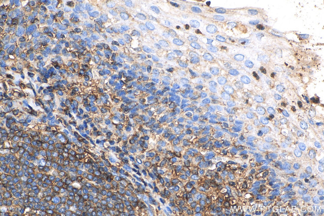 Beta-2-microglobulin Antibody in Immunohistochemistry (Paraffin) (IHC (P))