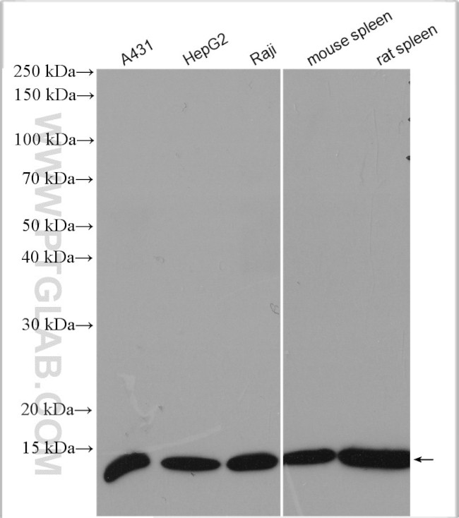 Beta-2-microglobulin Antibody in Western Blot (WB)