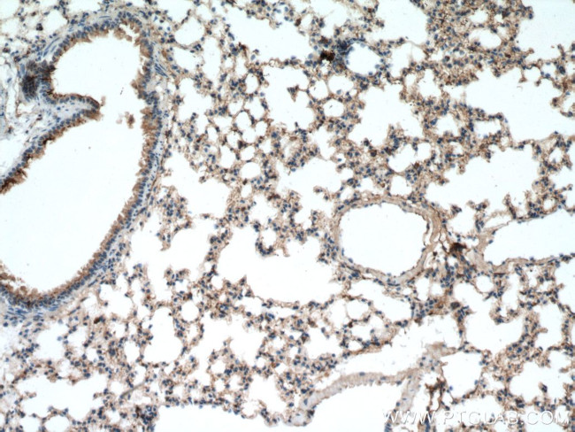 Beta-2-microglobulin Antibody in Immunohistochemistry (Paraffin) (IHC (P))