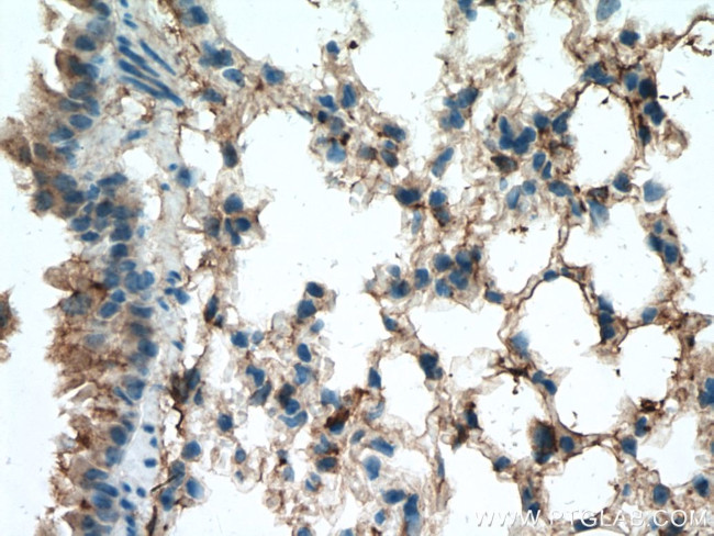 Beta-2-microglobulin Antibody in Immunohistochemistry (Paraffin) (IHC (P))