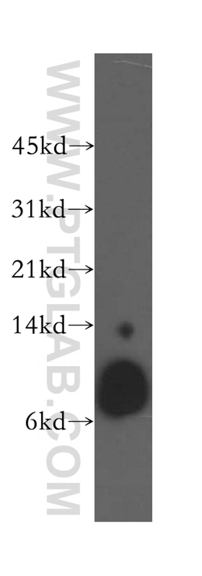 Beta-2-microglobulin Antibody in Western Blot (WB)