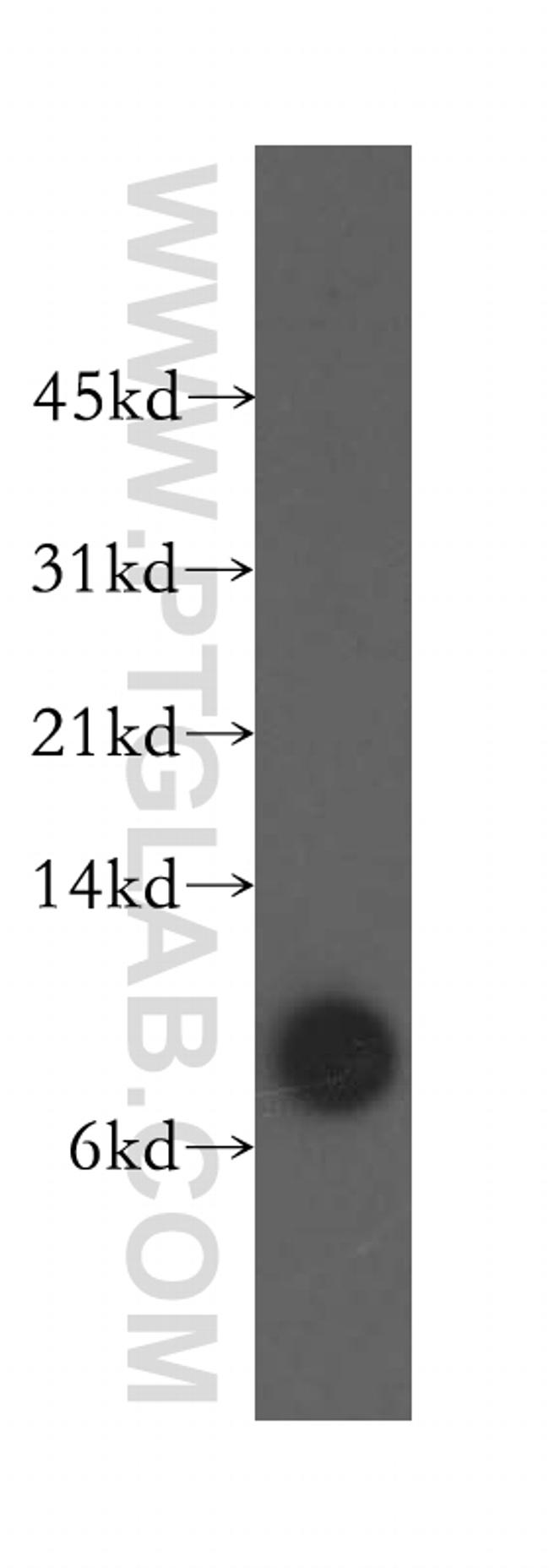 Beta-2-microglobulin Antibody in Western Blot (WB)