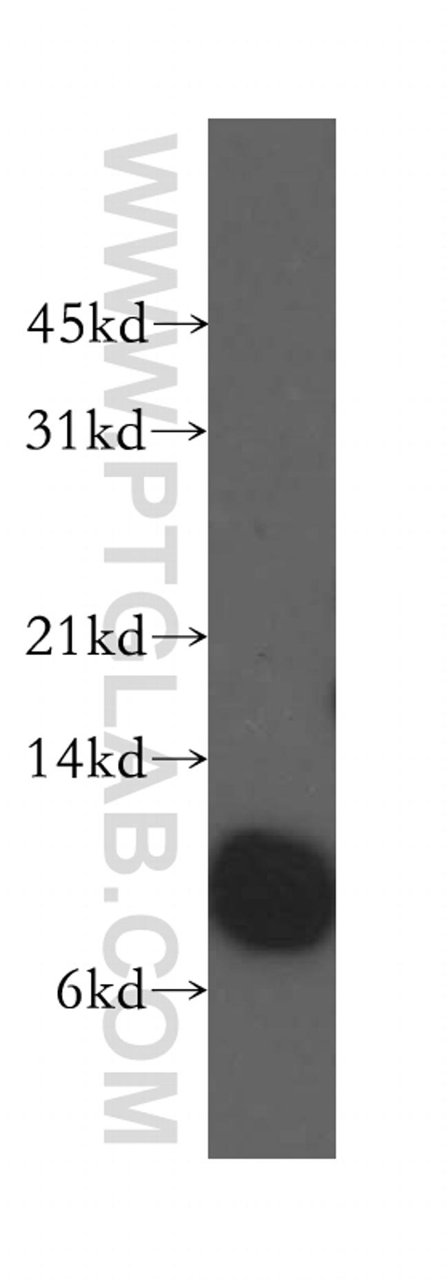Beta-2-microglobulin Antibody in Western Blot (WB)