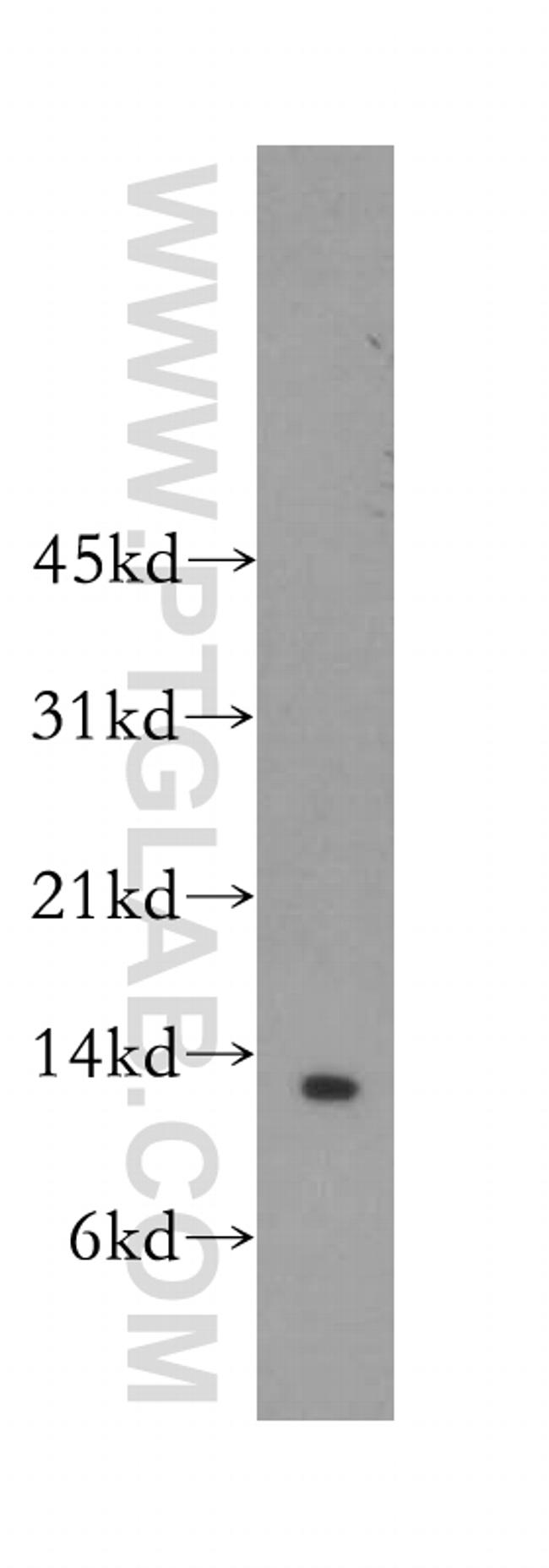 Beta-2-microglobulin Antibody in Western Blot (WB)