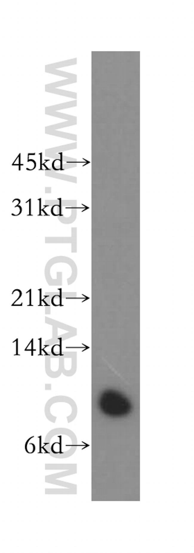 Beta-2-microglobulin Antibody in Western Blot (WB)