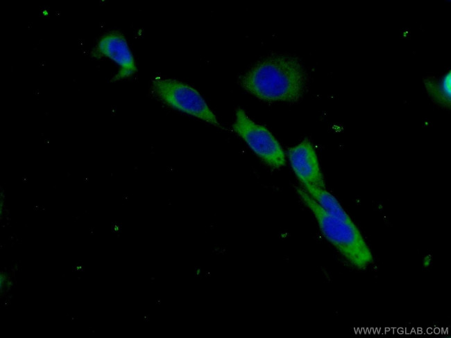 Beta-2-microglobulin Antibody in Immunocytochemistry (ICC/IF)