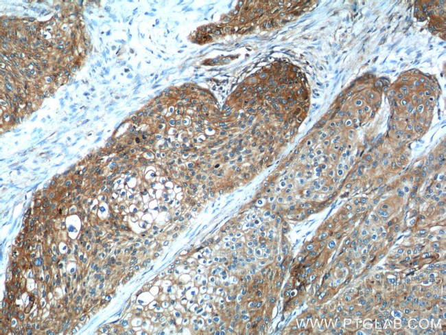 Beta-2-microglobulin Antibody in Immunohistochemistry (Paraffin) (IHC (P))