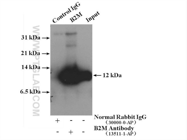 Beta-2-microglobulin Antibody in Immunoprecipitation (IP)