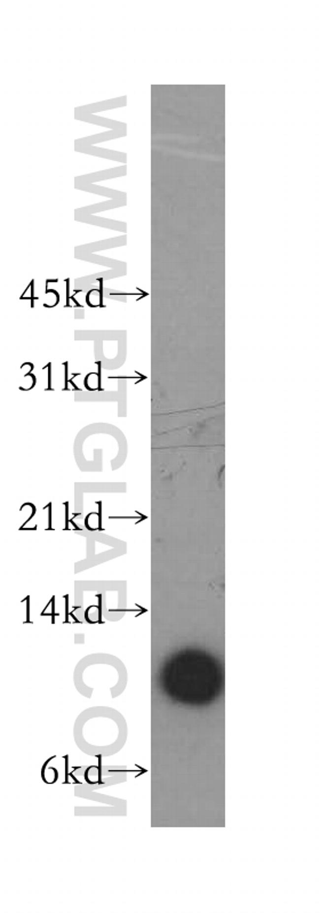 Beta-2-microglobulin Antibody in Western Blot (WB)