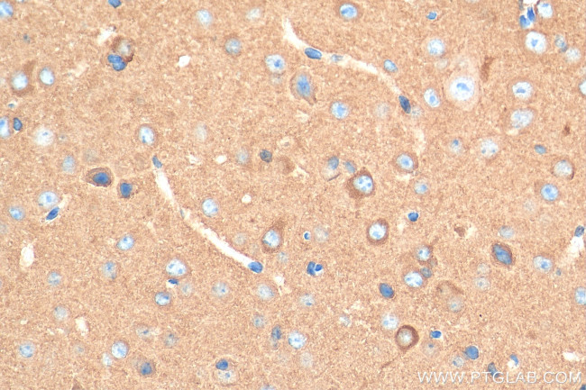 OXR1 Antibody in Immunohistochemistry (Paraffin) (IHC (P))