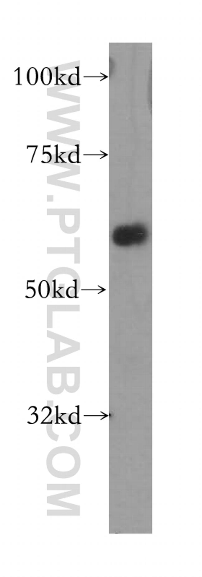 MARVELD2 Antibody in Western Blot (WB)