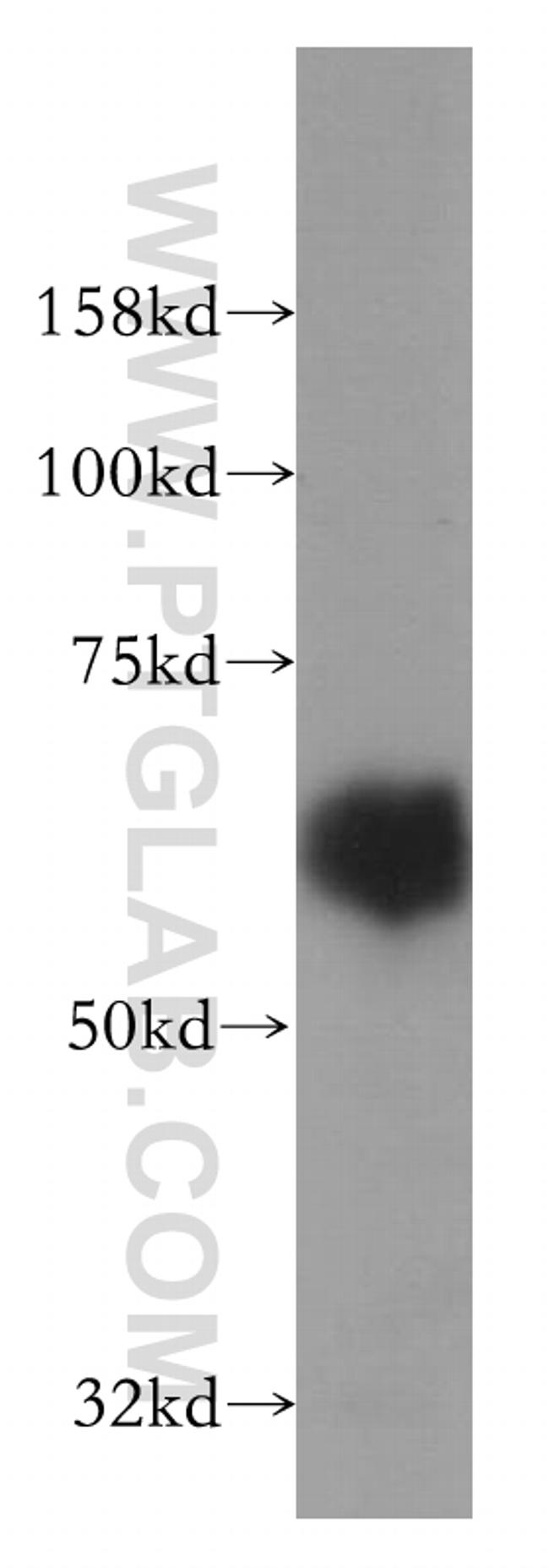 MARVELD2 Antibody in Western Blot (WB)