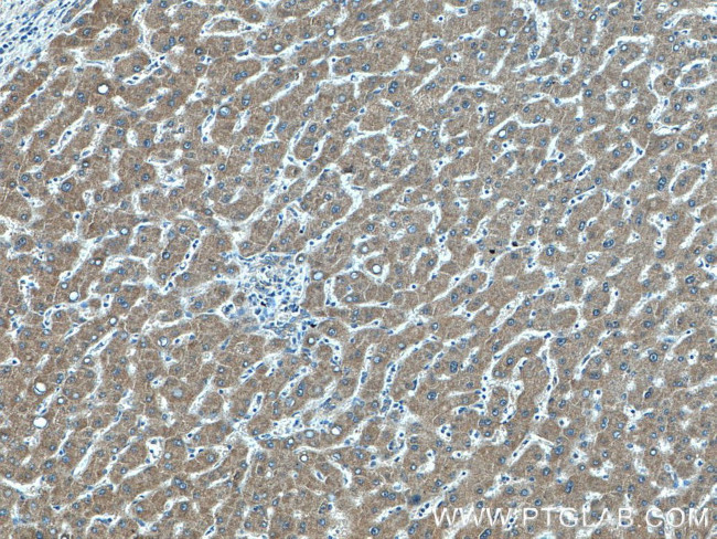 Choline kinase alpha Antibody in Immunohistochemistry (Paraffin) (IHC (P))