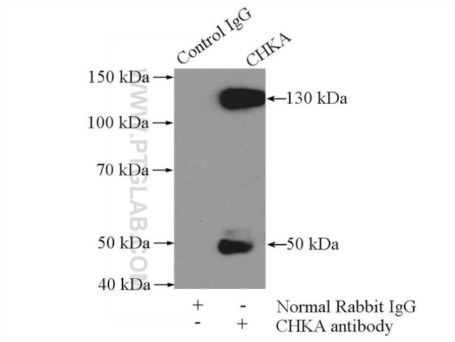Choline kinase alpha Antibody in Immunoprecipitation (IP)