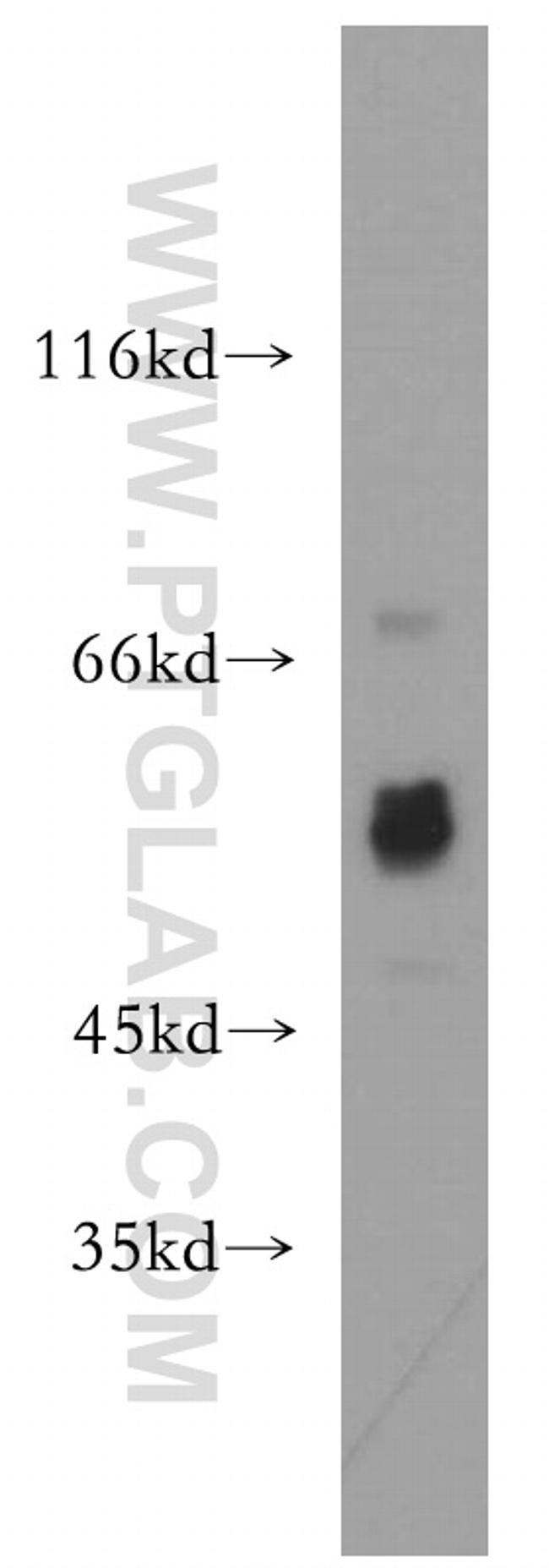 Choline kinase alpha Antibody in Western Blot (WB)