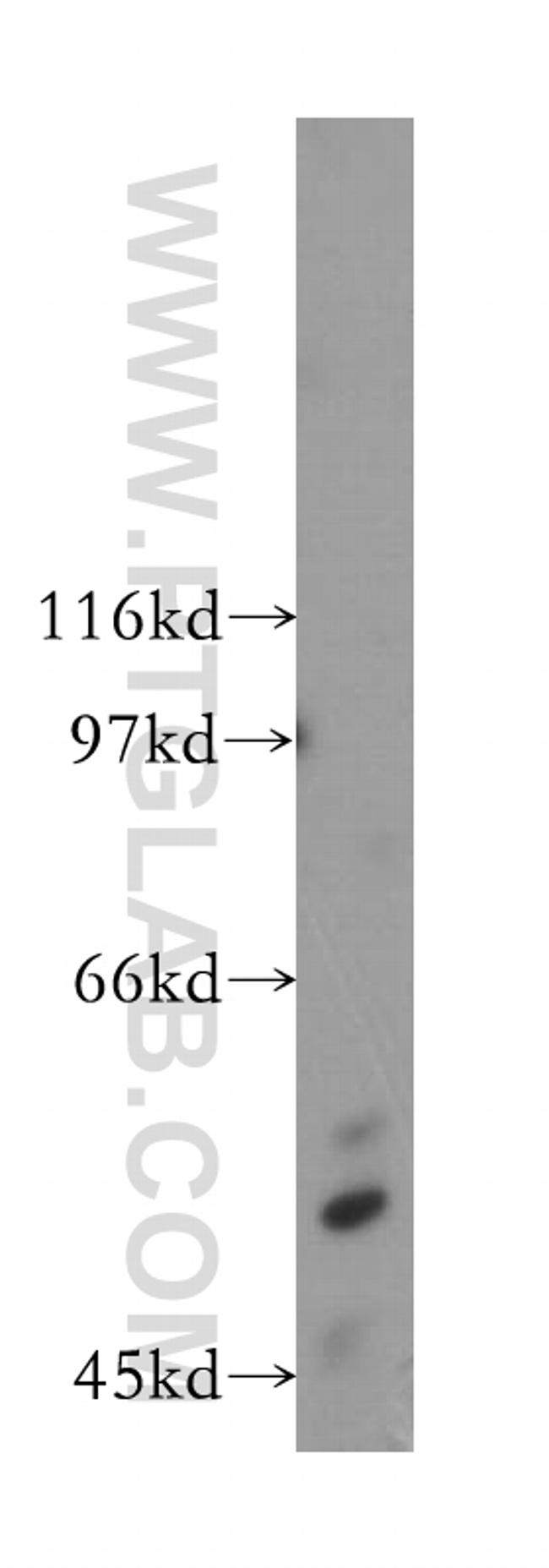 ZnT6 Antibody in Western Blot (WB)