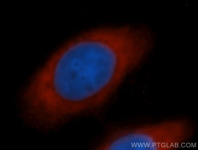 EIF5B Antibody in Immunocytochemistry (ICC/IF)