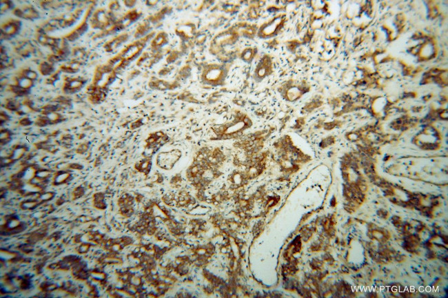 EIF5B Antibody in Immunohistochemistry (Paraffin) (IHC (P))