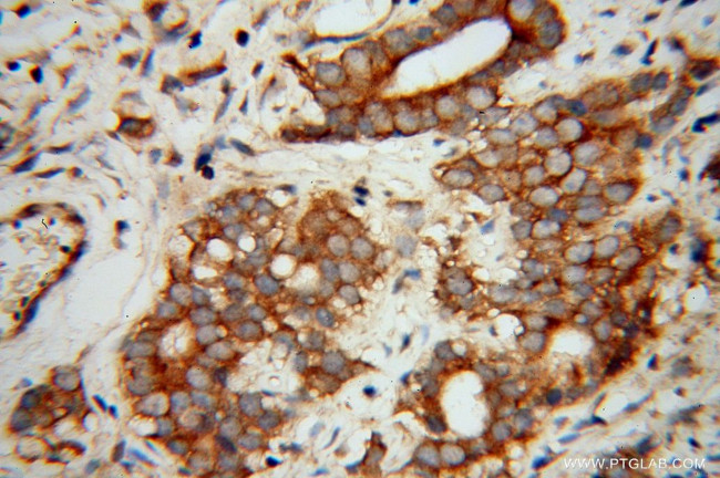 EIF5B Antibody in Immunohistochemistry (Paraffin) (IHC (P))