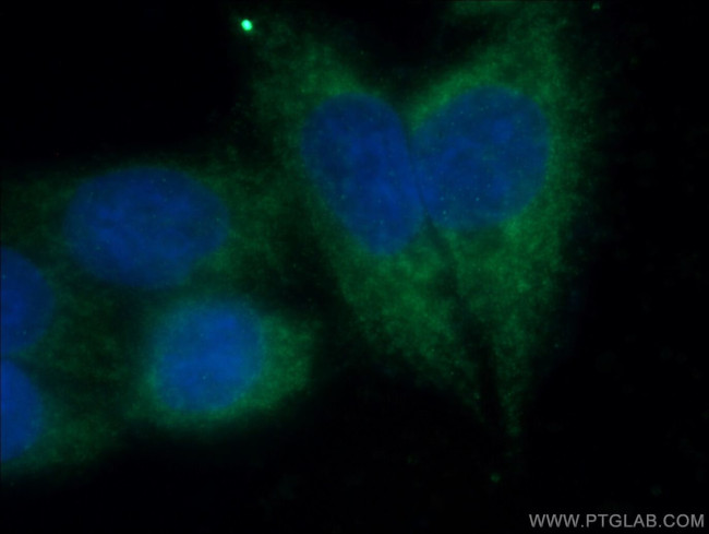 TDRKH Antibody in Immunocytochemistry (ICC/IF)