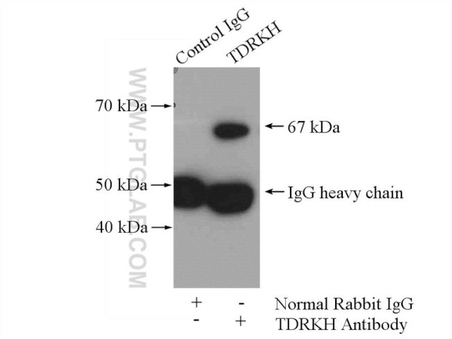 TDRKH Antibody in Immunoprecipitation (IP)