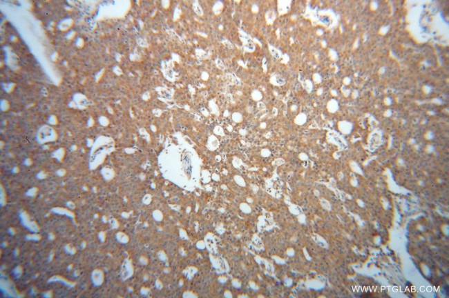 EML2 Antibody in Immunohistochemistry (Paraffin) (IHC (P))