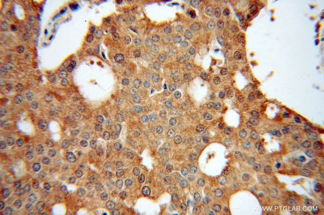 EML2 Antibody in Immunohistochemistry (Paraffin) (IHC (P))