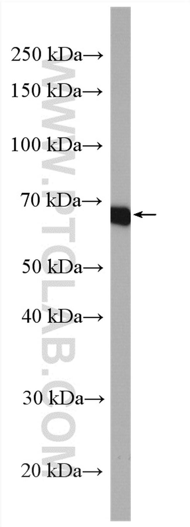 EML2 Antibody in Western Blot (WB)